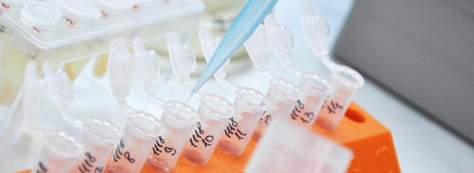 Pankreas Kanseri için Tanı Testleri