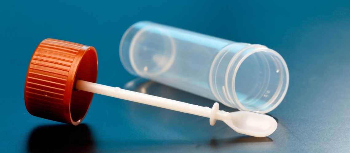 Dışkı Testi ile Pankreas Kanserinin Erken Teşhisi Mümkün mü?