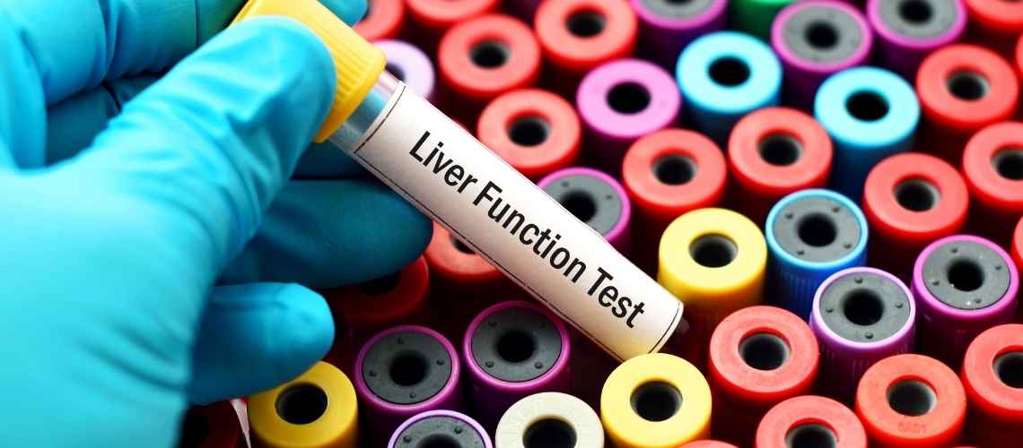 Vad är leverfunktionstest? Vad är leverfunktionstest?
