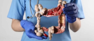 Wat is darmkanker levermetastase? Kolon Kanseri Karaciğer Metastazı Nedir?