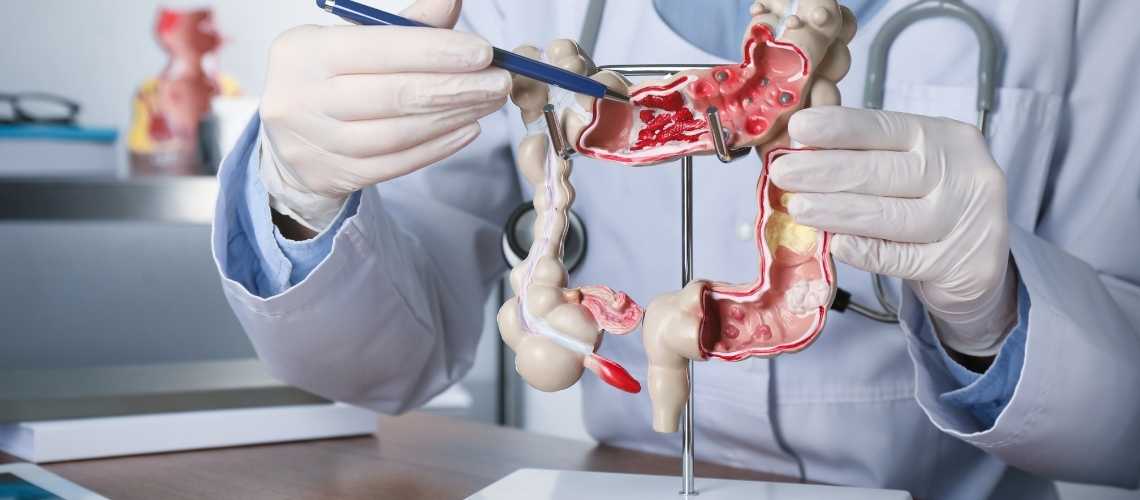 Gençlerde Kolon Kanseri