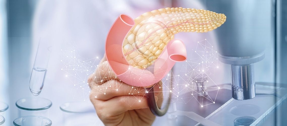 Misvattingen over pancreaskanker Pankreas Kanseri Hakkında Doğru Bilinen Yanlışlar