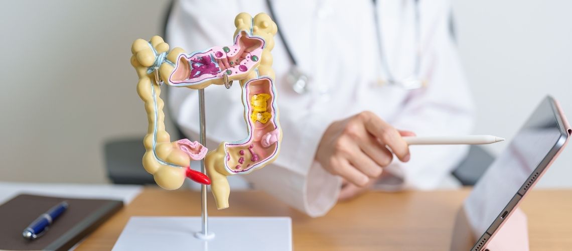Hoe moet de follow-up zijn na een rectumkankeroperatie? Hoe moet de follow-up zijn na een rectumkankeroperatie?