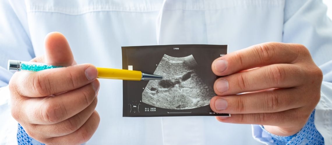 Kan plotseling gewichtsverlies een teken zijn van galwegkanker? Kan plotseling gewichtsverlies een teken zijn van galwegkanker?