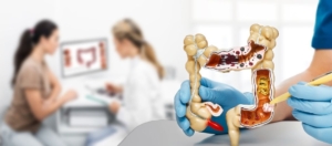 Wat is het belang van vroege diagnose bij pancreaskanker? Wat is het belang van vroege diagnose bij pancreaskanker?