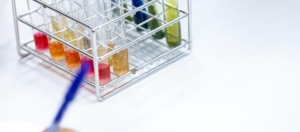 Wat is Amylase? Waarom neemt de amylasewaarde toe? Amilaz Nedir? Amilaz Değeri Neden Yükselir?