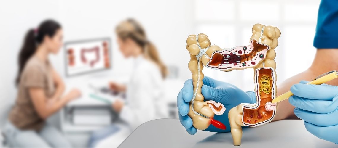 Darmkanker Levermetastasen Levensverwachting Darmkanker Levermetastasen Levensverwachting