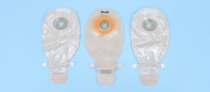 Sluiting van een stoma (colostomie/ileostoma) Sluiting van een stoma (colostomie/ileostoma)