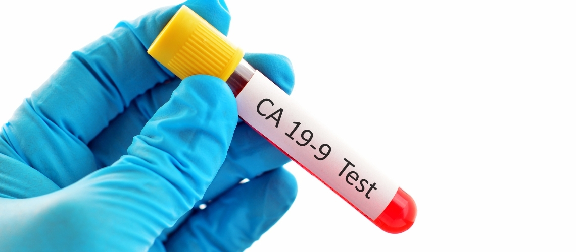 Wat is CA 19-9? Wat betekent hoge CA 19-9? Wat is CA 19-9? Wat betekent hoge CA 19-9?