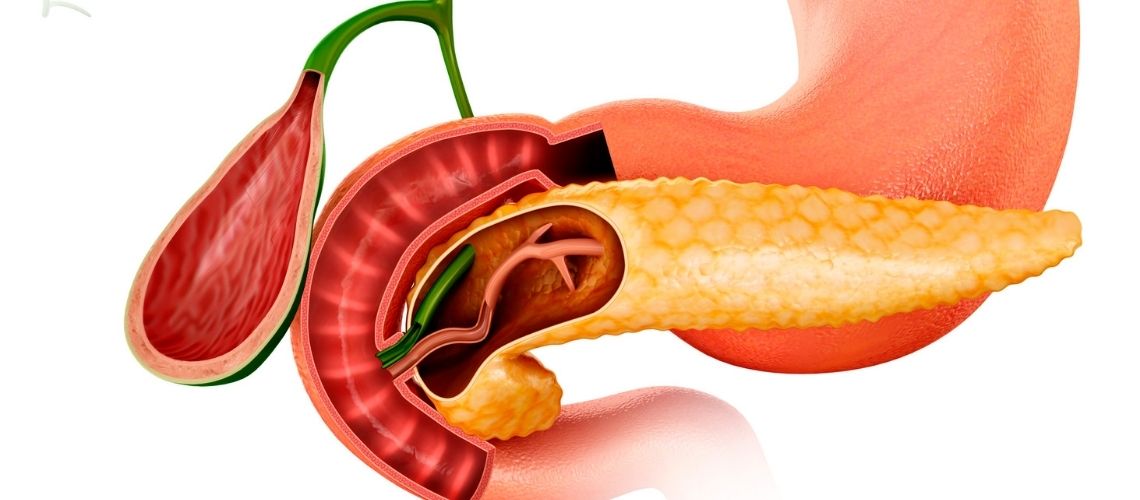 C25 Maligne neoplasma van de pancreas C25 Maligne neoplasma van de pancreas