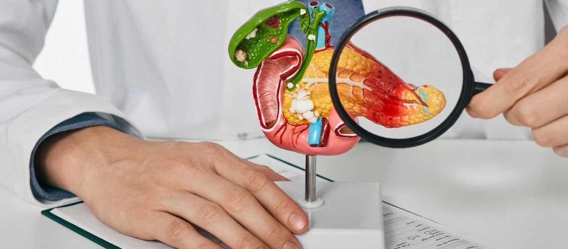 Wat zijn pancreascysten? Wat zijn pancreascysten?