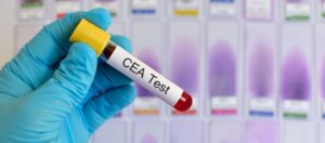 CEA Nedir? CEA Yüksekliği Ne Anlama Gelir? CEA Nedir? CEA Yüksekliği Ne Anlama Gelir?