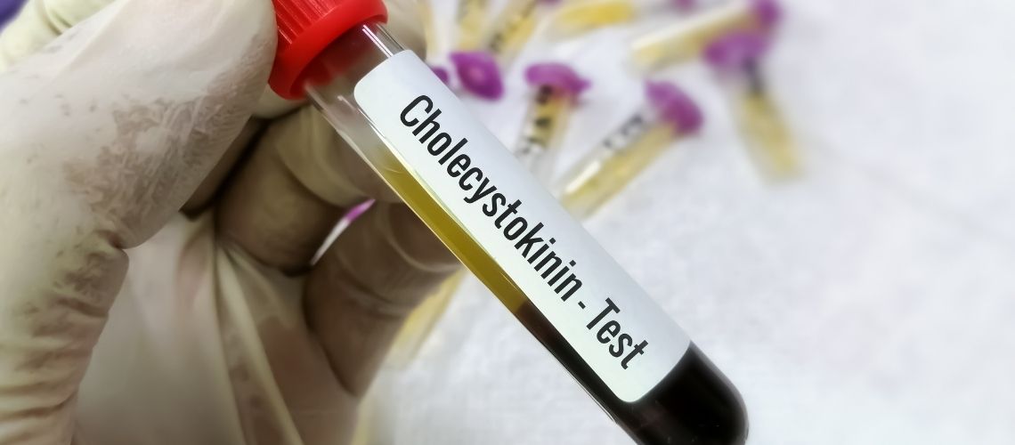Kolesistokinin Nedir, Ne İşe Yarar? Kolesistokinin Hormonu Nerede Üretilir? Kolesistokinin Nedir, Ne İşe Yarar? Kolesistokinin Hormonu Nerede Üretilir?