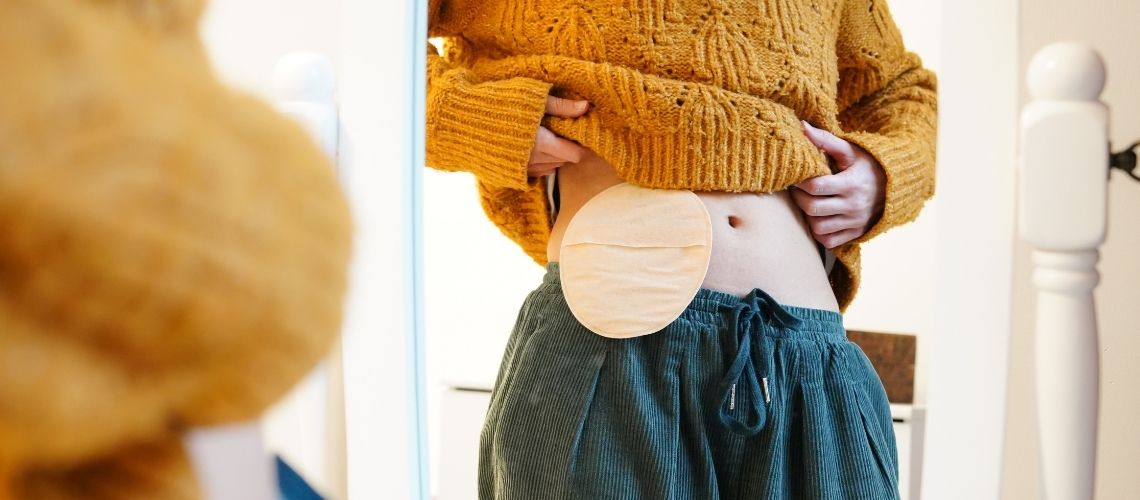 Wat is een colostoma-zak? Waarom wordt het gedragen? Hoe leegmaken? Wat is een colostoma-zak? Waarom wordt het gedragen? Hoe leegmaken?