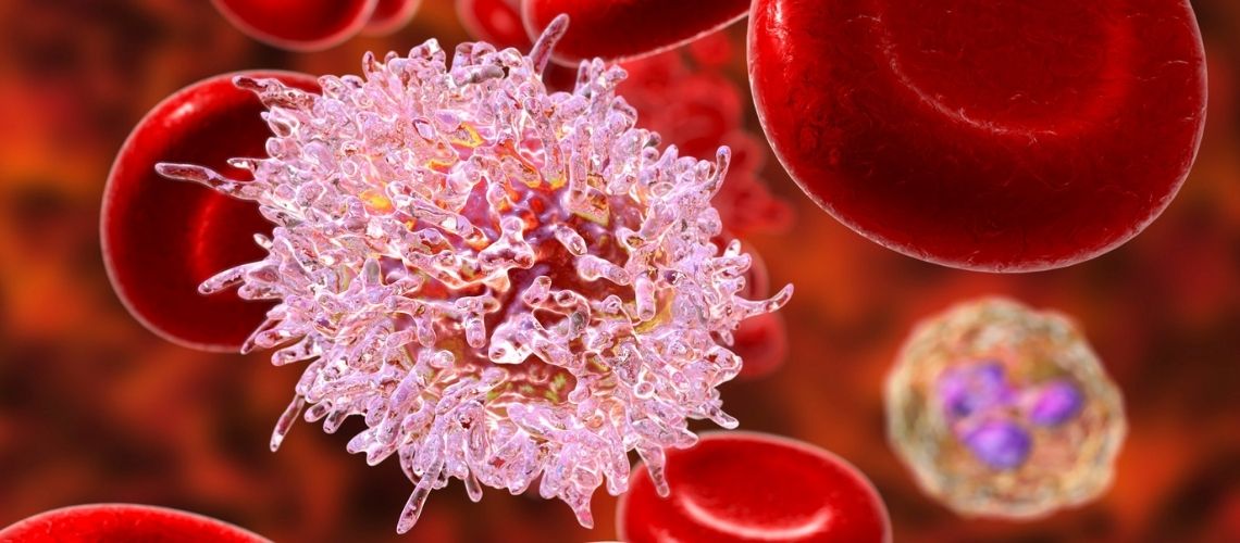 Malignite Nedir? Malignite Şüphesi Nedir? Malignite Nedir? Malignite Şüphesi Nedir?