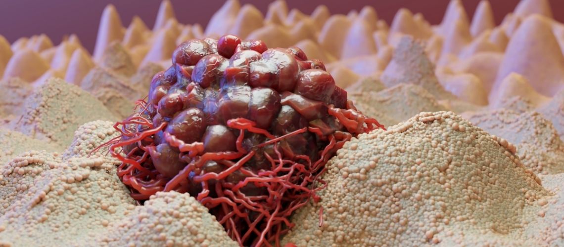 Wat is een mutatie? Hoe veroorzaakt het kanker? Wat is een mutatie? Hoe veroorzaakt het kanker?