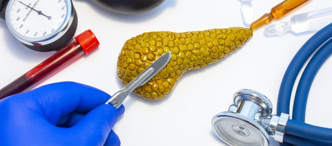 Pancreatectomie Pancreatectomie