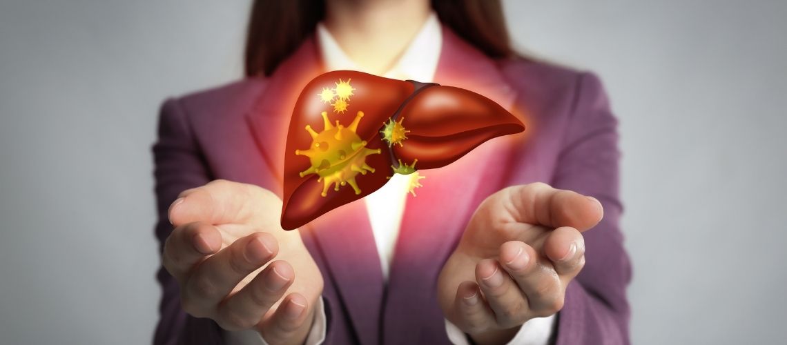 Klatskin Tümörü Nedir? Klatskin Tümörü Belirtileri ve Tedavisi