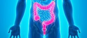 Sağ Hemikolektomi Nedir? Sağ Hemikolektomi Nedir?