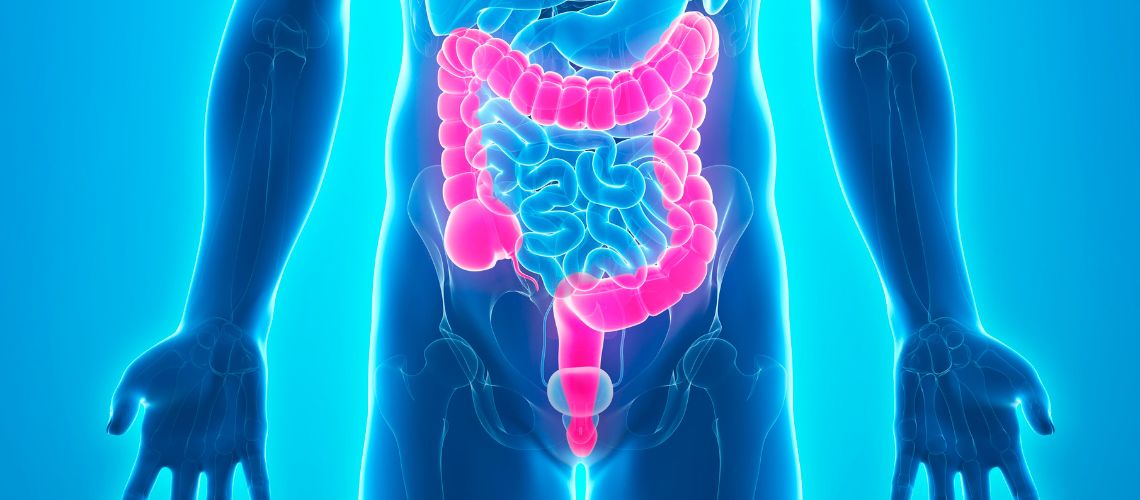 Sağ Hemikolektomi Nedir?