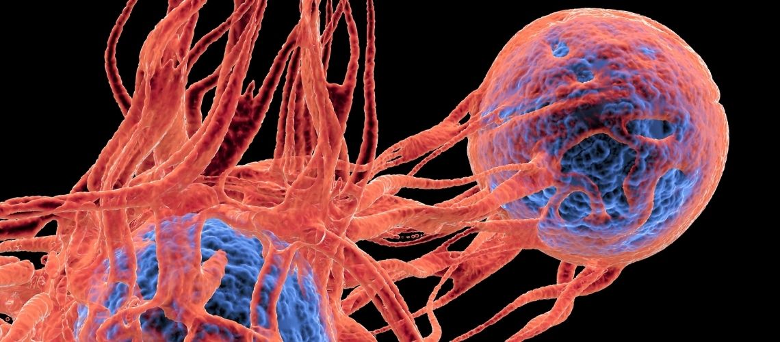 PIPAC ile tedavi edilen peritoneal metastazlı hastalarda yanıt değerlendirmesi