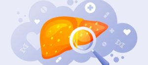 ALT (Alanin Aminotransferaz) Nedir? ALT Yüksekliği ve Düşüklüğü ALT (Alanin Aminotransferaz) Nedir? ALT Yüksekliği ve Düşüklüğü